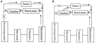 The Effect of Optimized Ultrafiltration on Perioperative Pulmonary Function During Cardiopulmonary Bypass in Infants Under 10 kg